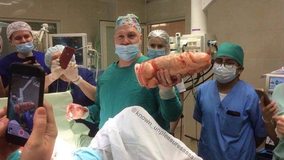 Vibrador