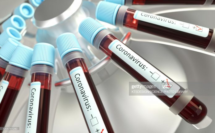 Coronavirus prueba 696x430