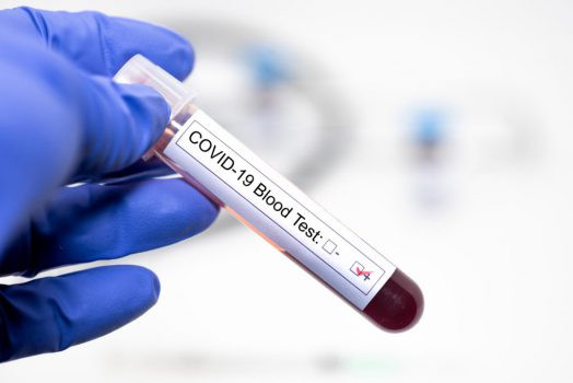 Test coronavirus e1587922679895